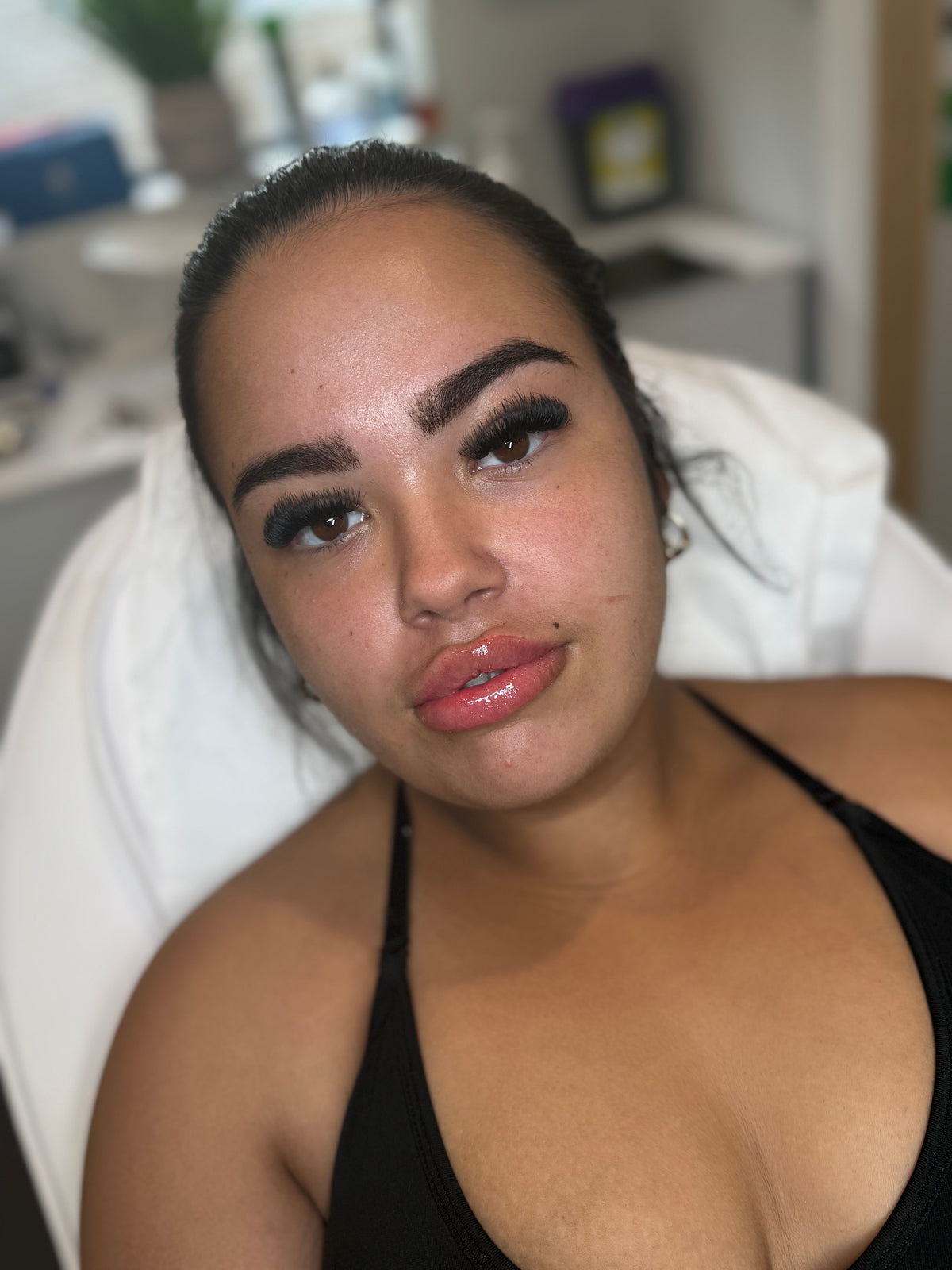 Signature Lip Enhancement