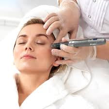 Microneedling